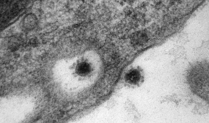 Как выглядит дельта-штамм коронавируса (2 фото)