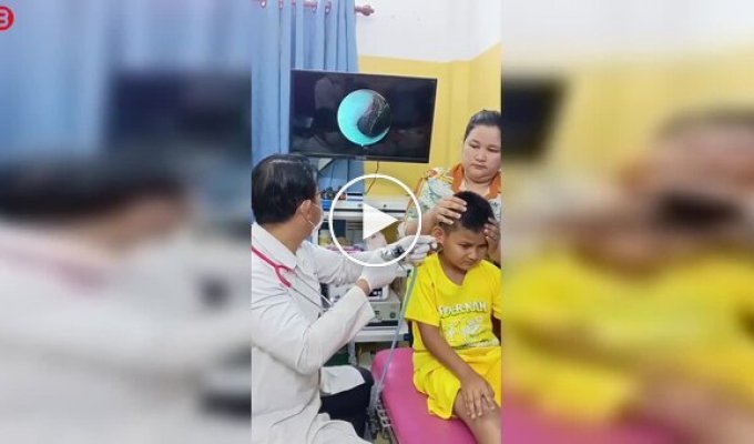 В Камбодже у подростка в ухе обнаружили живого таракана