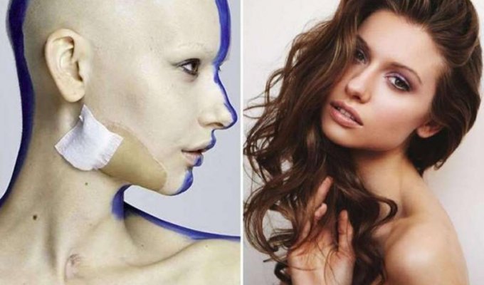 Невероятные фотографии модели, потерявшей челюсть из-за рака (19 фото)