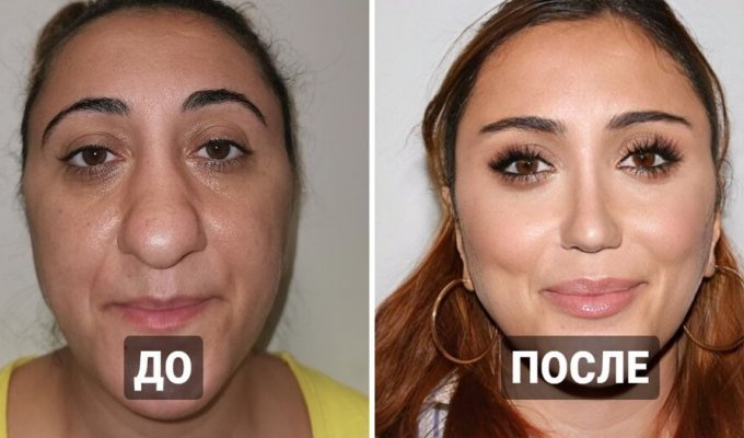 15 examples when people resorted to plastic surgery (16 photos)