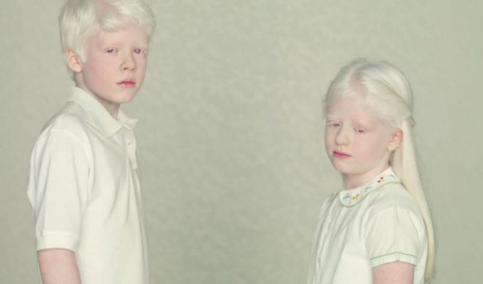 Не такие как все: люди-альбиносы (16 фото)
