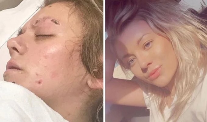 Before & After: 20 Photos of People Who Decided to Get Clean (21 photos)