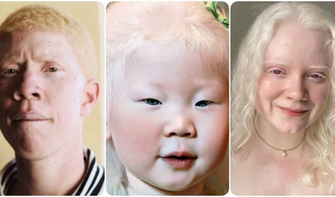 14 people with albinism who look like aliens (15 photos)