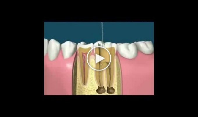 Как работает стоматолог