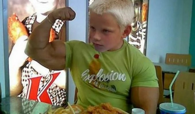 М'язи хлопчика з Німеччини ростуть без зупинки. Вся справа в рідкісній генетичній мутації (8 фото)