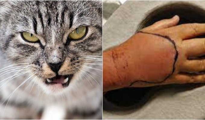 The cat bit a resident of the UK and he contracted an unknown infection (3 photos)
