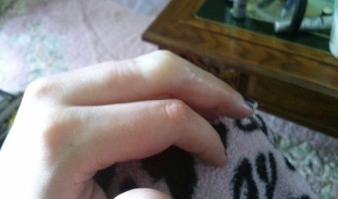 Инструкция по ампутации своего пальца (9 фото)