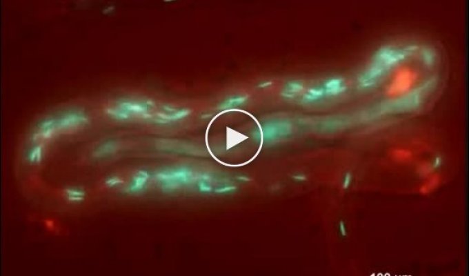Как сперма бегает по каналу