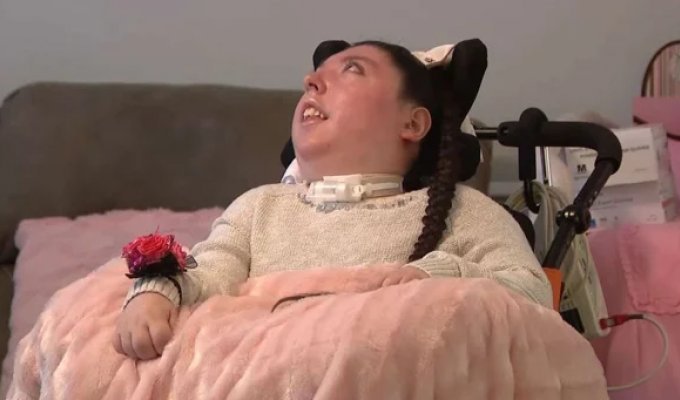 Родившейся без мозга девушке исполнилось 20 лет (4 фото)