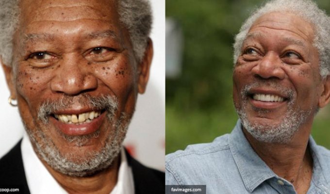 10 знаменитостей до и после реставрации зубов (10 фото)