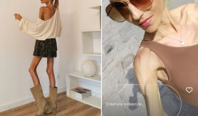Fashion blogger with anorexia turns into a clothes hanger (7 photos)