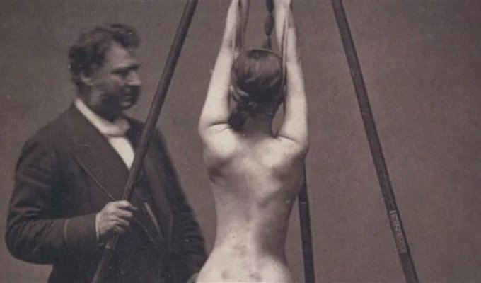 18 фотографій медицини минулого, що одночасно лякають і зачаровують (19 фото)