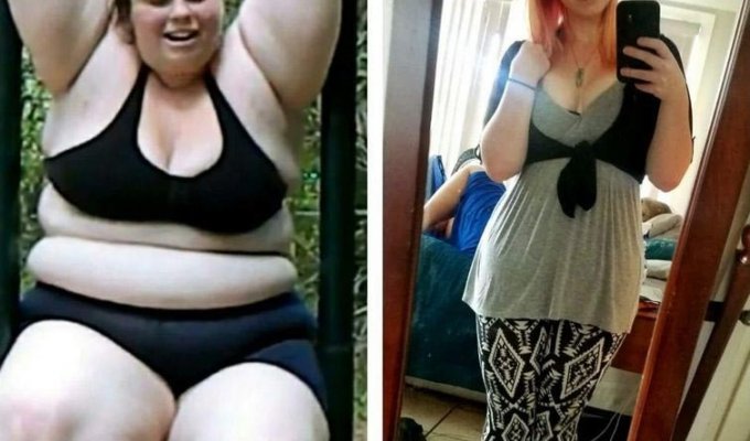 Девушка показала отрицательную сторону экстремальной потери веса (4 фото)