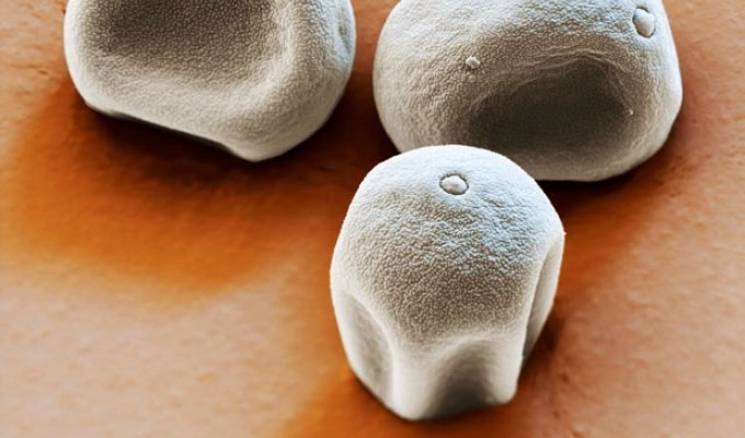 Пыльца и пыль под микроскопом (15 фото)