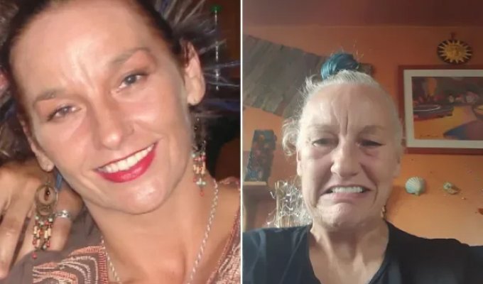 Женщина отдала все деньги на новые зубы и "постарела на 20 лет" за один день (4 фото)