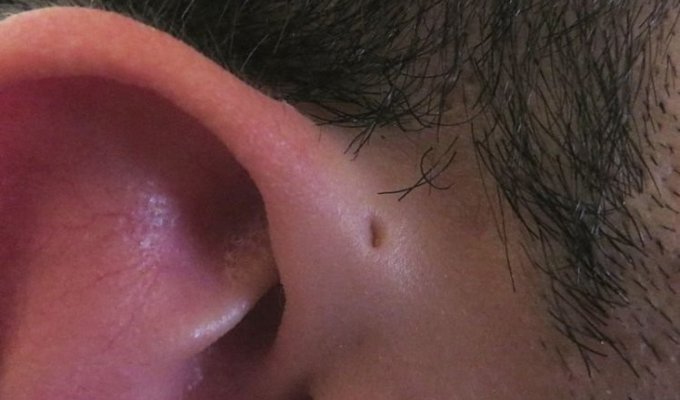 Вот почему некоторые люди рождаются с крошечным отверстием возле ушей (7 фото)