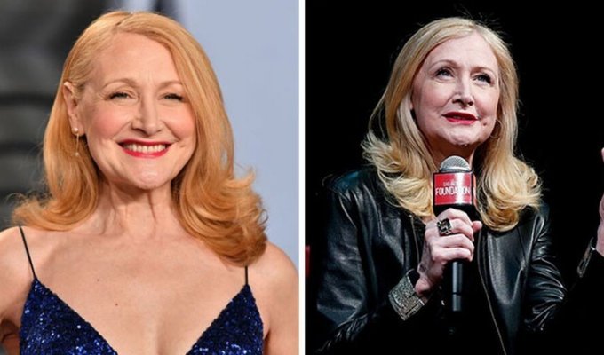 Patricia Clarkson explained why she does not have children (7 photos)
