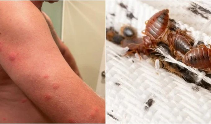 Bedbugs bit a pilot in a hotel, but the administrator sided with the bloodsuckers (4 photos + 1 video)