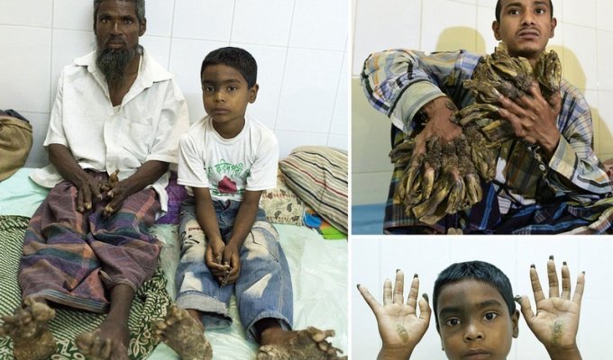 Семья из Бангладеш превращается в дерево (8 фото)