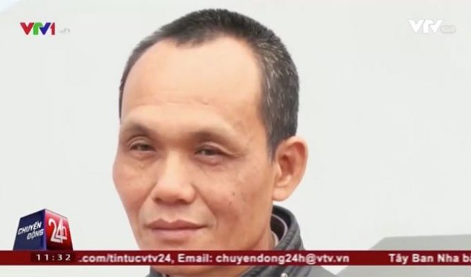 Во Вьетнаме из тела мужчины извлекли зажим, забытый 18 лет назад (3 фото)
