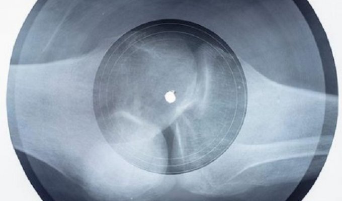 Massive Attack записали кавер легендарной песни Егора Летова "Все идет по плану" на рентгеновском снимке