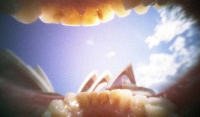 Как видит мир человеческий зуб (14 фото)