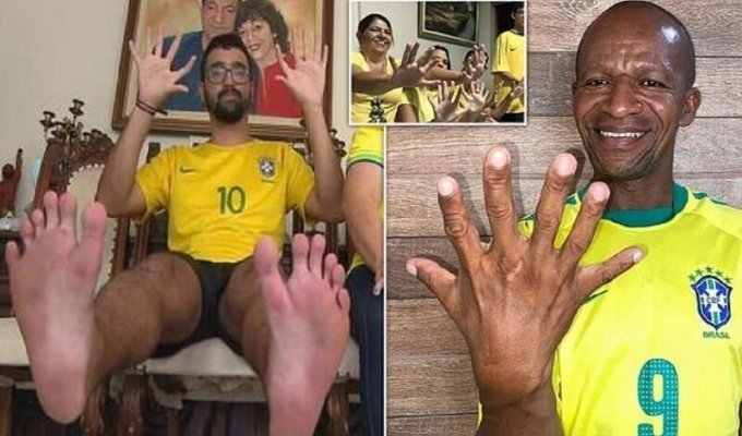 Шестипалая семья болеет за Бразилию (5 фото)