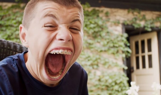 Подросток с самым большим ртом попал в книгу рекордов Гиннеса (5 фото + 1 видео)