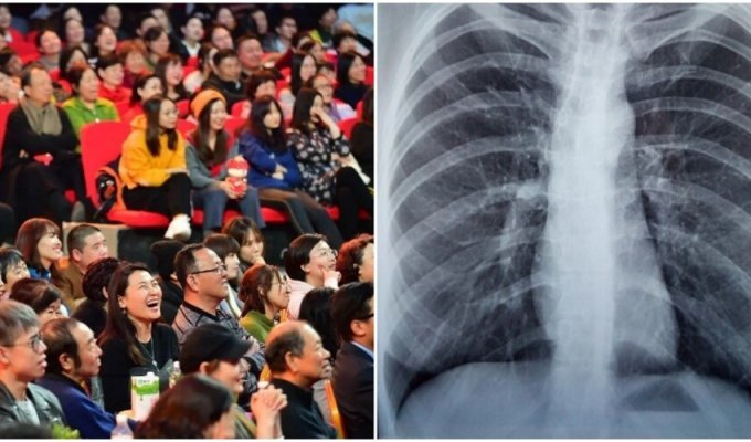 Chinese Man Torn Lung When He Loudly Shouted At Concert Of Favorite Band (2 Photos)