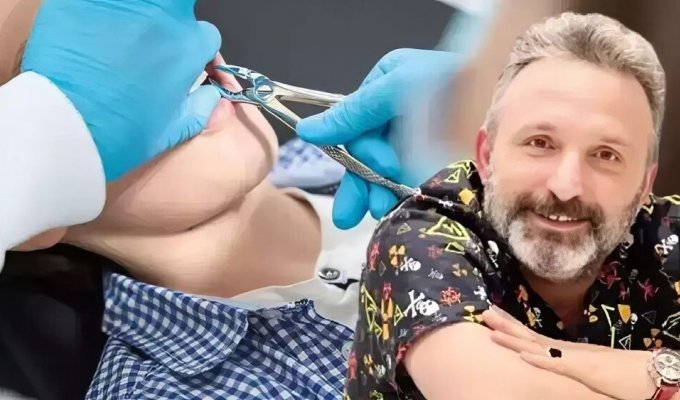 A Turkish cleaner pretended to be a dentist and removed several teeth from a man (4 photos)