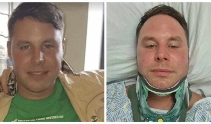 A man broke his neck while taking a contrast shower (3 photos)