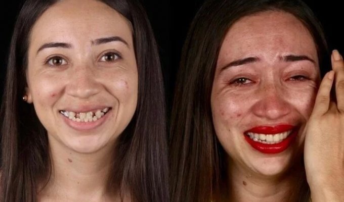 Дантист из Бразилии возвращает красивые улыбки людям, которые не могут оплатить операции (10 фото)