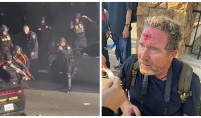 Резиновая пуля попала в голову фотографу во время беспорядков в Лос-Анджелесе (2 фото + 1 видео)