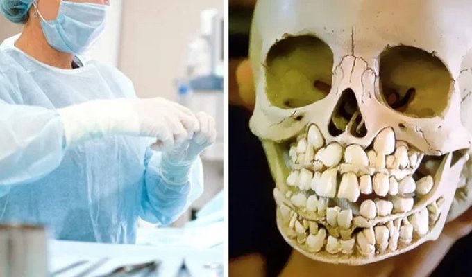 25 Strange, Disgusting, and Creepy Facts About the Human Body (26 photos)