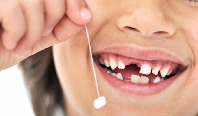 10 самых странных фактов о зубах (10 фото)