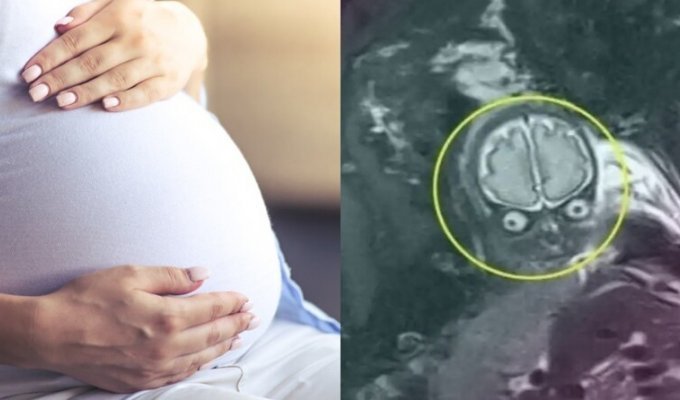 "All in the father!": What do intrauterine images of children taken with the help of MRI look like (6 photos)