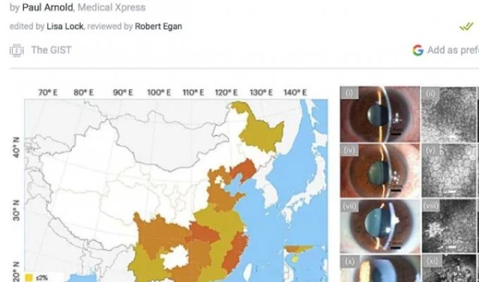 Sushi lovers are reporting a "new virus" (photo)