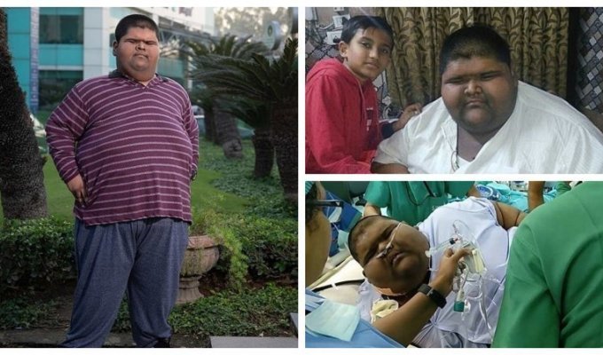 Самый толстый мальчик в мире уменьшил себе желудок и похудел на 100 кг (8 фото + 1 видео)