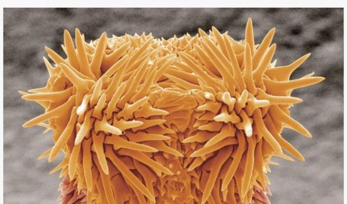 Как выглядят самые распространенные вредные микроорганизмы (12 фото)
