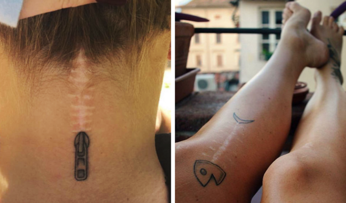 Татуировки, превратившие шрамы в произведения искусства (41 фото)