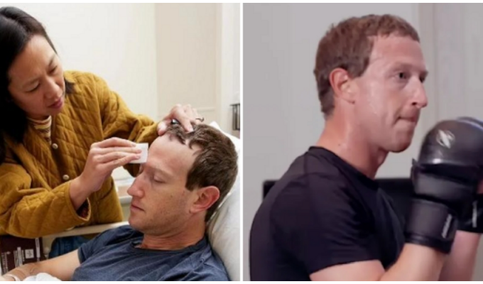 The fight is cancelled: Mark Zuckerberg was urgently hospitalized after sparring (3 photos)