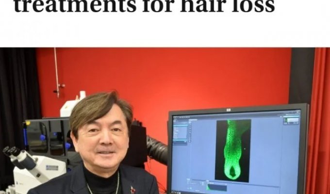 "20 лет исследований прошли не зря": ученые из Японии победили облысение (фото)
