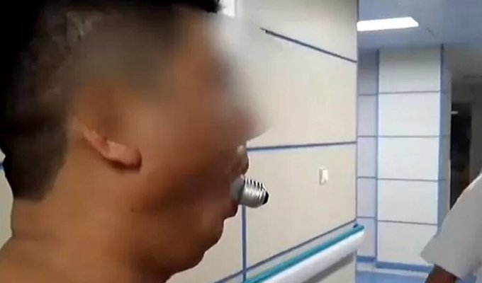 Man put light bulb in his mouth and couldn't get it out (1 photo + 1 video)