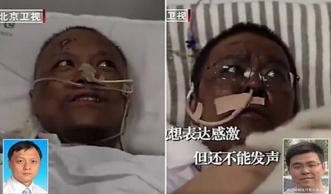 После лечения от коронавируса китайские врачи стали темнокожими (6 фото)