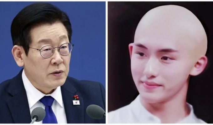 Президент Южной Кореи предложил включить в медицинскую страховку лечение облысения (2 фото)