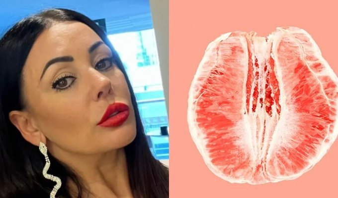 47-year-old Australian woman decided to have “designer vagina” surgery - and regretted it (4 photos)