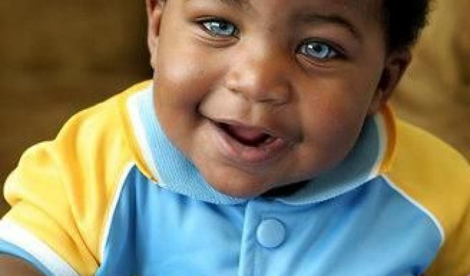 Африканский ребенок с голубыми глазами (7 фото)