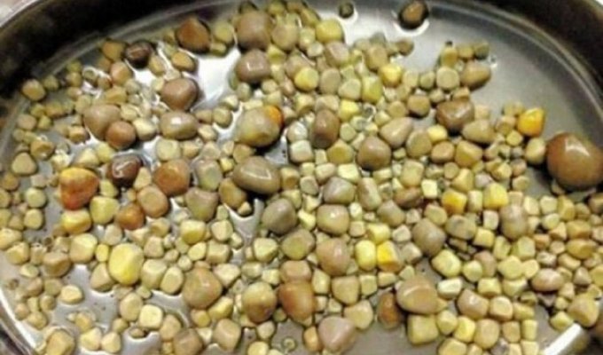 Неотложная операция: у любителя тофу удалили 420 камней из почек. Врачи в шоке! (2 фото)
