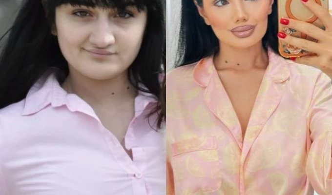 «Два різні людини»: апгрейд цієї дівчини став вірусним — у мережі сперечаються, чи зробила пластика її красивішою (3 фото)