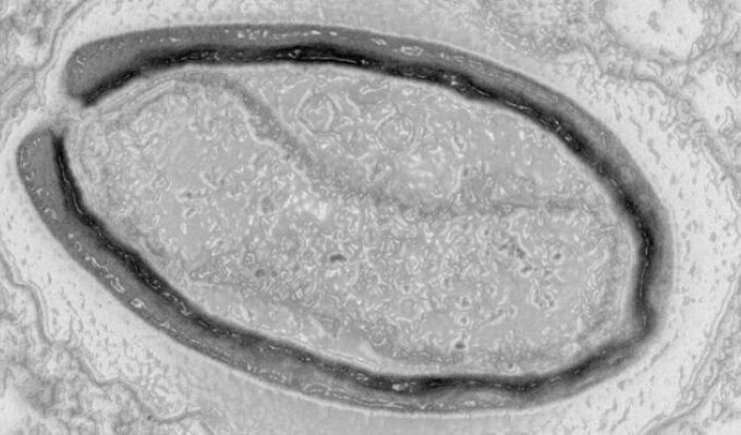 French scientists have revived a 50,000-year-old virus that "slept" in the permafrost (3 photos)